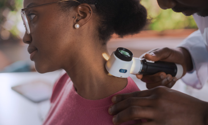 Black woman skin screening