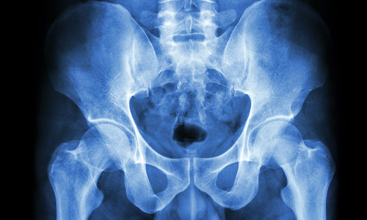 Keeping hips healthy