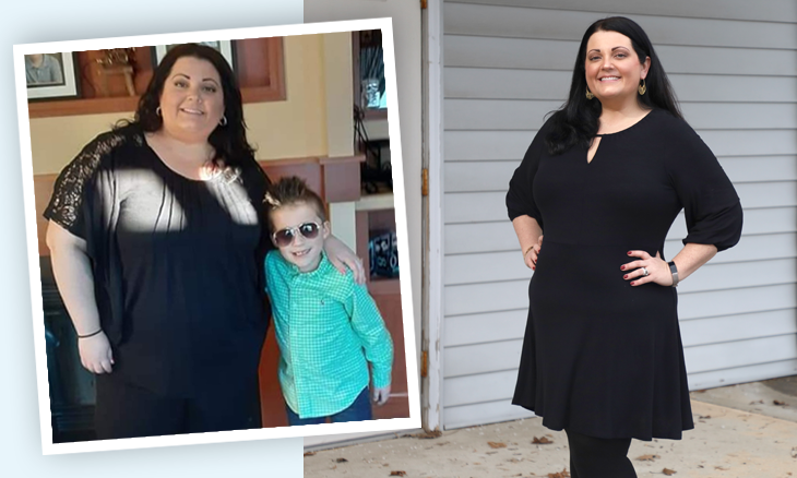 Crystal Messick before and after weight loss surgery