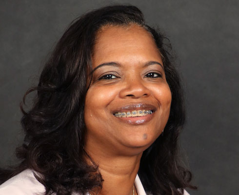 Dennise Washington, CNS
